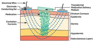  圖5.人體皮膚分層橫截面以及TMD和生物阻抗測量  考慮到生物阻抗分析的無創(chuàng)性，使用兩個金屬電極代表電氣傳感器，連接模擬前端(AFE)電路和患者皮膚。這個金屬與非金屬的接觸點是構(gòu)成整個電路的另一個關(guān)鍵部分，連接了AFE和人體電氣模型。電荷載體（電極中的電子和人體內(nèi)的離子）之間的相互作用可能對這些傳感器的性能產(chǎn)生重大影響，需要根據(jù)每種應(yīng)用進(jìn)行具體考慮。首先，金屬與離子溶液接觸的相互作用導(dǎo)致金屬表面附近溶液中離子濃度的局部變化。這種現(xiàn)象會改變電極下方區(qū)域的電荷中性，導(dǎo)致金屬周圍的電解質(zhì)電位與溶液其余部分不同，從而在金屬和電解質(zhì)主體之間產(chǎn)生一個電位差，即常說的“半電池電位”。其次，注入電流的直流分量會導(dǎo)致電極極化。  表1.各種電極類型和相應(yīng)的半電池電位  金屬及反應(yīng)  半電池電位(V)  Al → Al3+ + 3e- Al → Al3+ + 3e-  –1.706 –1.706  Ni → Ni2+ + 2e- Ni → Ni2+ + 2e-  –0.230 -0.230  H2 → 2H+ + 2e- H2 → 2H+ + 2e-  0.000 (by definition) 0.000（根據(jù)定義）  Ag + Cl- → AgCl + e- Ag + Cl- → AgCl + e-  +0.223 +0.223  Ag → Ag+ + e- Ag → Ag+ + e-  +0.799 +0.799  Au → Au+ + e- Au → Au+ + e-  +1.680 +1.680  這是一種不良現(xiàn)象，往往導(dǎo)致電極性能下降。這些考量表明，電極也需要定義適當(dāng)?shù)碾姎饽Ｐ停▍⒁妶D6）。我們可以將干電極表示為具有三個串聯(lián)元件的電路：一個用于模擬半電池電位(EHC)的直流電源；一個用于模擬金屬和非金屬（人體）之間接觸的RC并聯(lián)電池(Rd||Cd)；以及一個用于模擬電極金屬的電阻Rs。